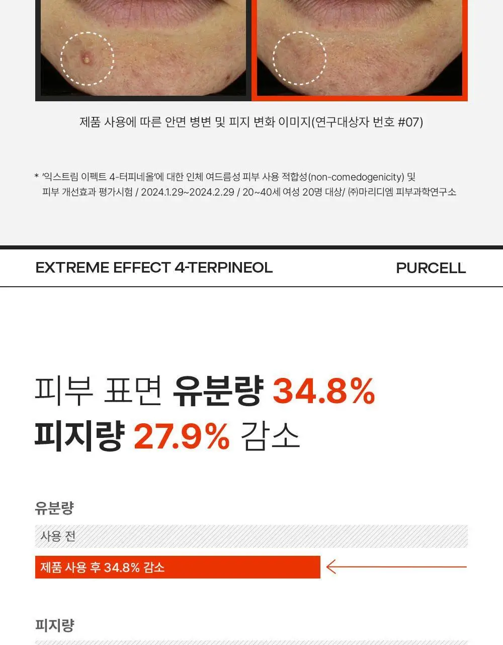 [트러블케어/스팟진정] 퍼셀 익스트림 이펙트 터피네올 원액 10ml 상세페이지 10